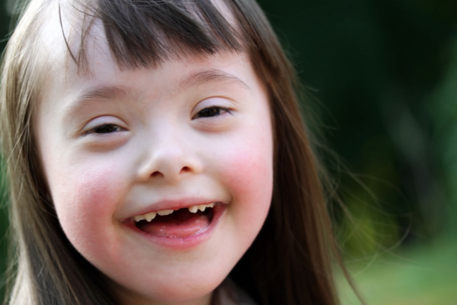 Zespół Downa - choroba kwalifikująca do bezterminowego orzeczenia o niepełnosprawności