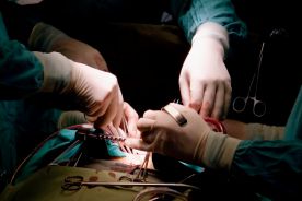 Pierwsza w Polsce operacja łącząca trzy zabiegi wykonane metodą laparoskopową