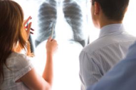 Pojedynczy cień okrągły w płucu – ważny problem diagnostyczny