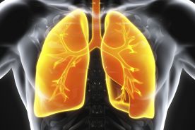 Idiopatyczne włóknienie płuc u 22 proc. pacjentów z ciężkim przebiegiem COVID-19