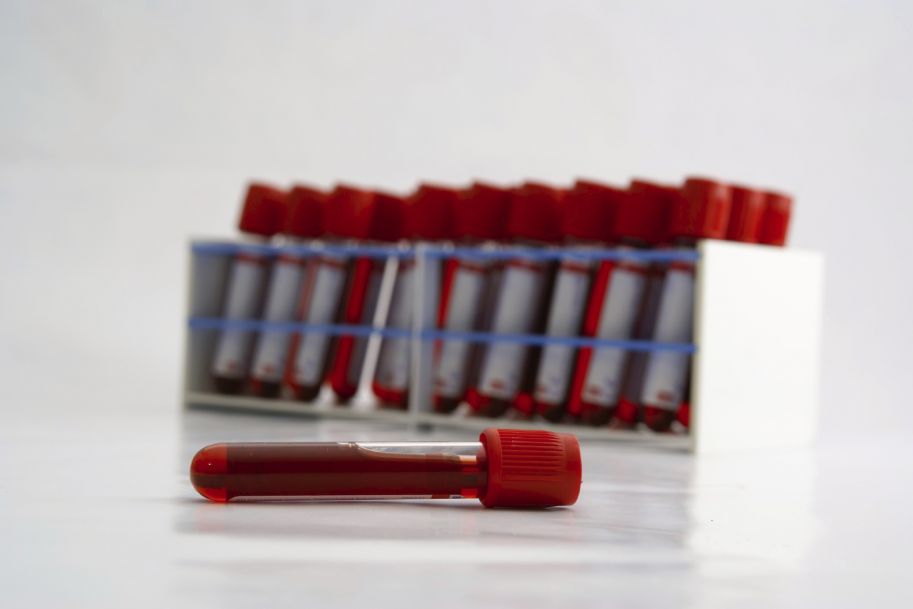 Wykryją wszystkie typy raka na podstawie badania krwi?