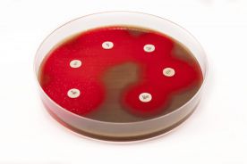 Problemy w terapii zakażeń wywołanych przez bakterie oporne na antybiotyki