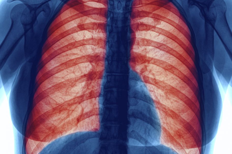 Tłuszcz w płucach, czyli dlaczego nadwaga grozi astmą