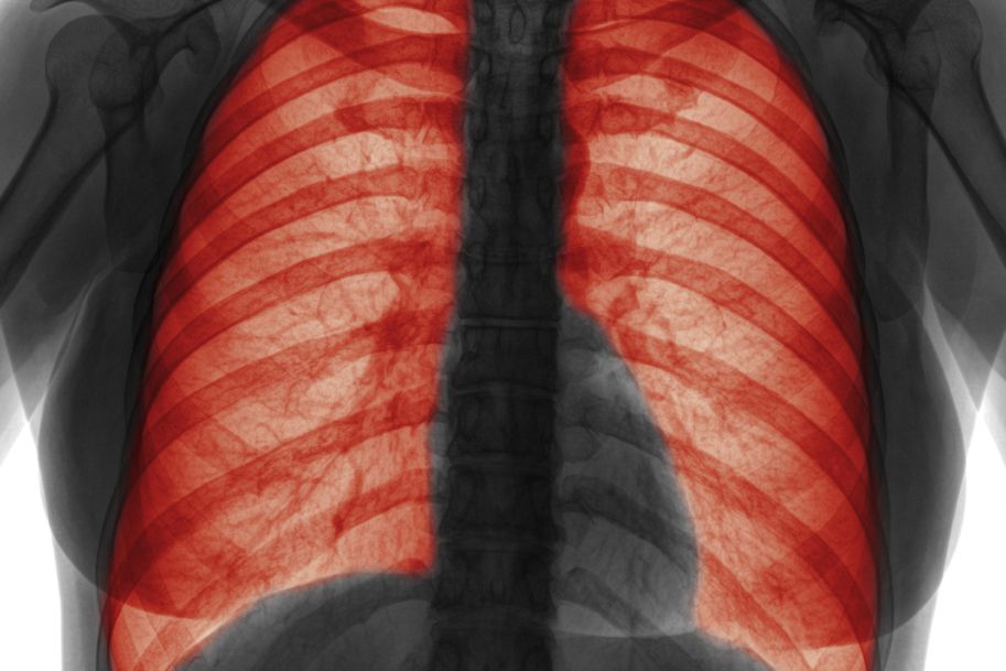 Nadreaktywność oskrzeli i nieswoiste testy prowokacji dooskrzelowej w diagnostyce astmy