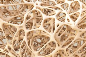 Osteoporoza - trudności diagnostyczne i terapeutyczne