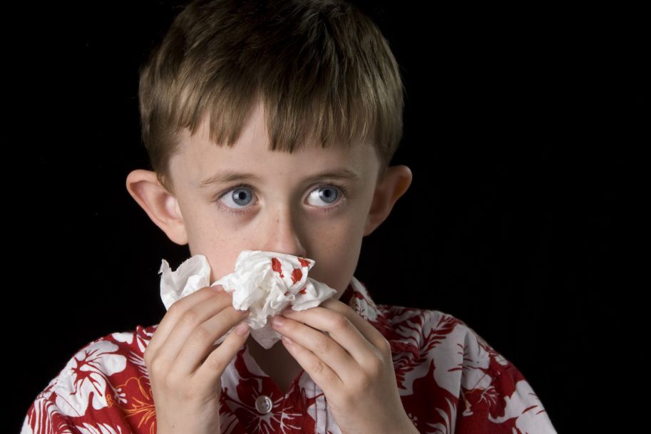 Postępowanie w krwawieniu z nosa u dzieci