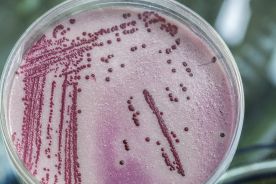 Mykobakterioza - diagnostyka i leczenie