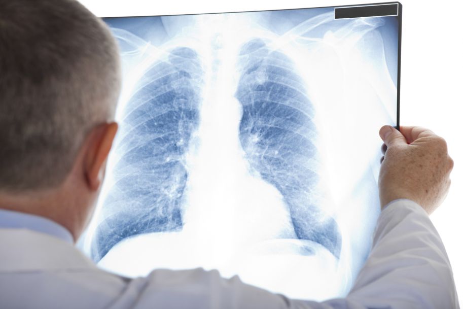 Zmiany w układzie oddechowym w przebiegu układowych chorób tkanki łącznej