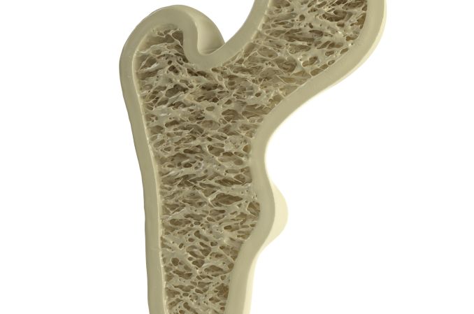 Prof. Hus: o szpiczaku w badaniach obrazowanych często świadczą „dziury w kościach”