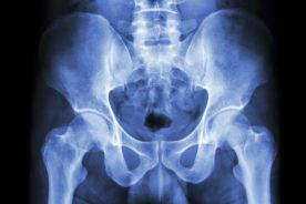 Stan obecny i perspektywy diagnostyki obrazowej w osteoporozie
