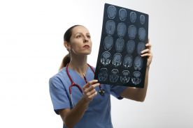Przyczyny udaru niedokrwiennego mózgu u osób młodych