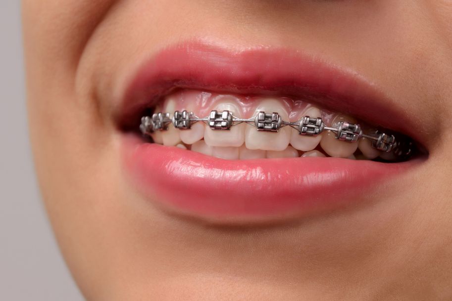 Ortodonta szczęścia nie daje