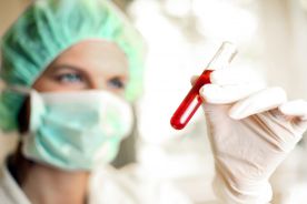 Czynniki ryzyka występowania choroby przeszczep przeciw gospodarzowi u pacjentów po allogenicznym przeszczepieniu macierzystych komórek krwiotwórczych