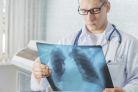 Dr Dąbrowiecki: dostęp do spirometrii jest niewystarczający, wykrycie POChP trwa często zbyt długo