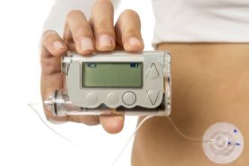 Leczenie cukrzycy typu 1: pompa insulinowa czy system wielokrotnych wstrzyknięć?
