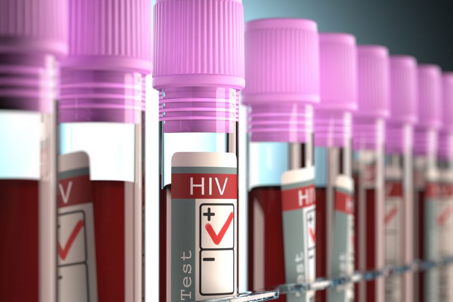 Dr Cholewińska: zakażenia HIV dotyczą dziś głównie „białych kołnierzyków”, artystów i celebrytów, a nie narkomanów