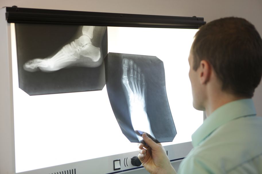 Czy umiemy diagnozować i leczyć zapalenie kości i szpiku kostnego u pacjentów z zespołem stopy cukrzycowej?