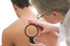 Ponad 7 mln Europejczyków choruje na raka skóry; większości przypadków można zapobiec