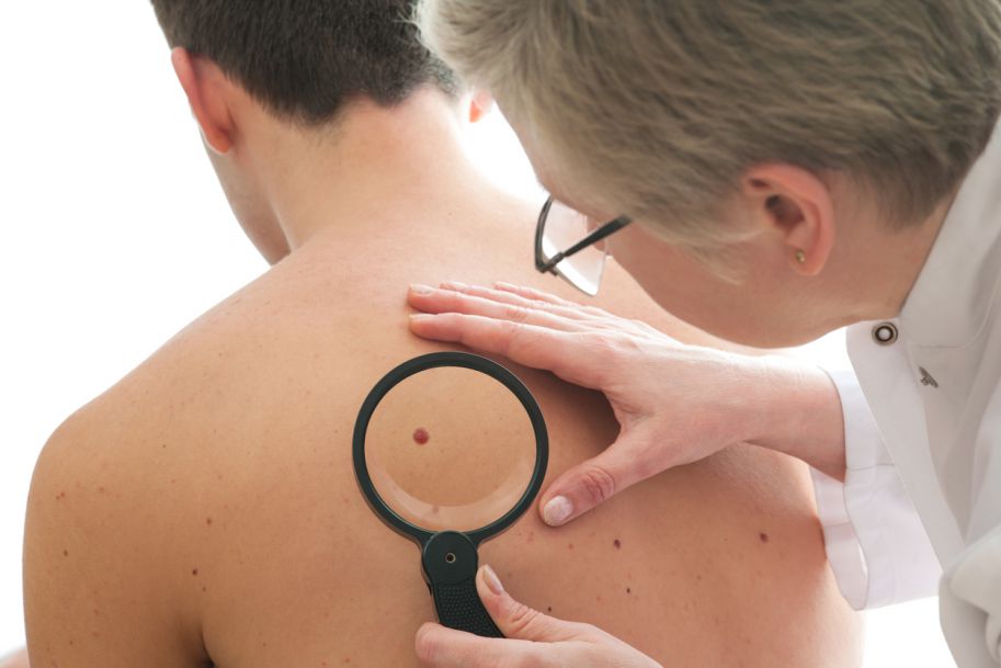 Badacze: Biopsje skóry będą mniej potrzebne?