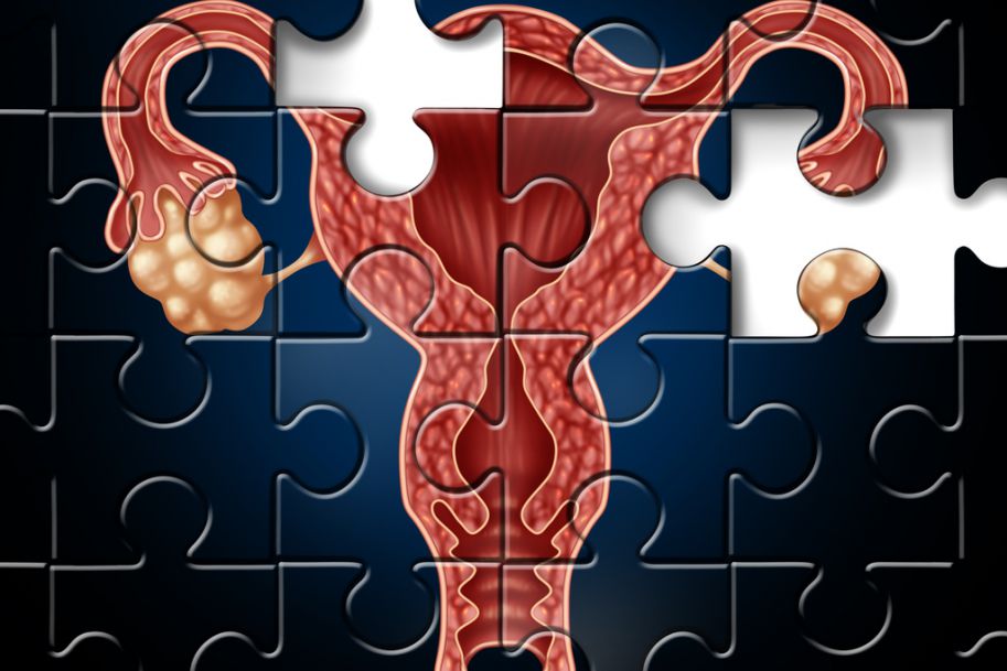 Mięśniaki macicy przyczyną anemii u kobiet