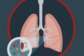 Odkryto, w jaki sposób zanieczyszczenia powietrza wywołują raka płuca u niepalących