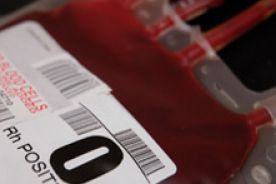Antywampiryczne pochówki w służbie krwiodawstwa na Śląsku