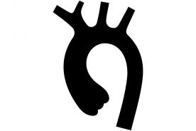 Retrospektywna analiza zgonów pacjentów z powodu nierozpoznanego lub opóźnionego rozpoznania tętniaka rozwarstwiającego aorty piersiowej