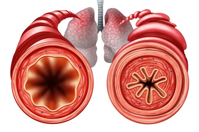 Ataki astmy mechanicznie uszkadzają drogi oddechowe
