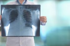 Eksperci: potrzebne ośrodki referencyjne dla chorych ze śródmiąższową chorobą płuc