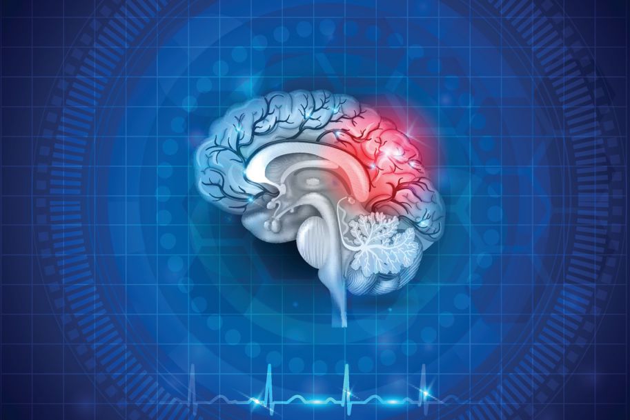 Nadciśnienie tętnicze w wieku podeszłym – profilaktyka pierwotna i wtórna udaru mózgu