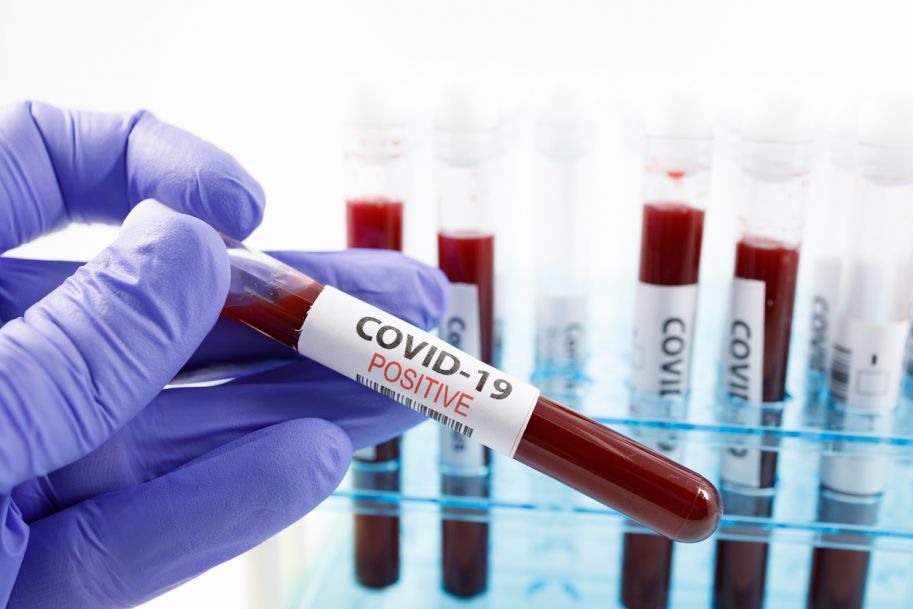 Płatne testy na obecność koronawirusa umożliwią skrócenie kwarantanny po przyjeździe do Anglii
