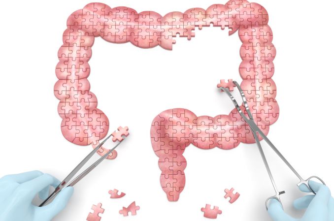 Prof. Rydzewska: w chorobach zapalnych jelit średni czas od objawów do diagnozy sięga w Polsce 3,5 roku