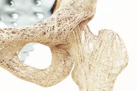 Osteoporoza – profilaktyka i leczenie