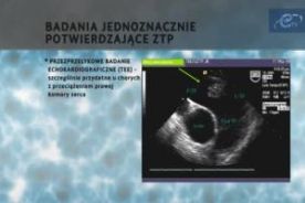 Konferencja 