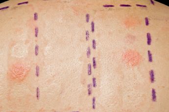 20. Akademia Dermatologii i Alergologii