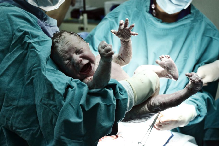 Łódź: Lekarze uratowali dziecko, które urodziło się z guzem ważącym ponad 3 kg